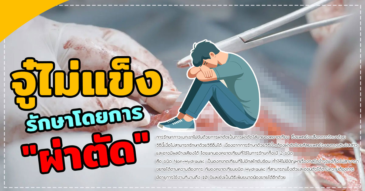 อวัยวะเพศไม่แข็งตัว