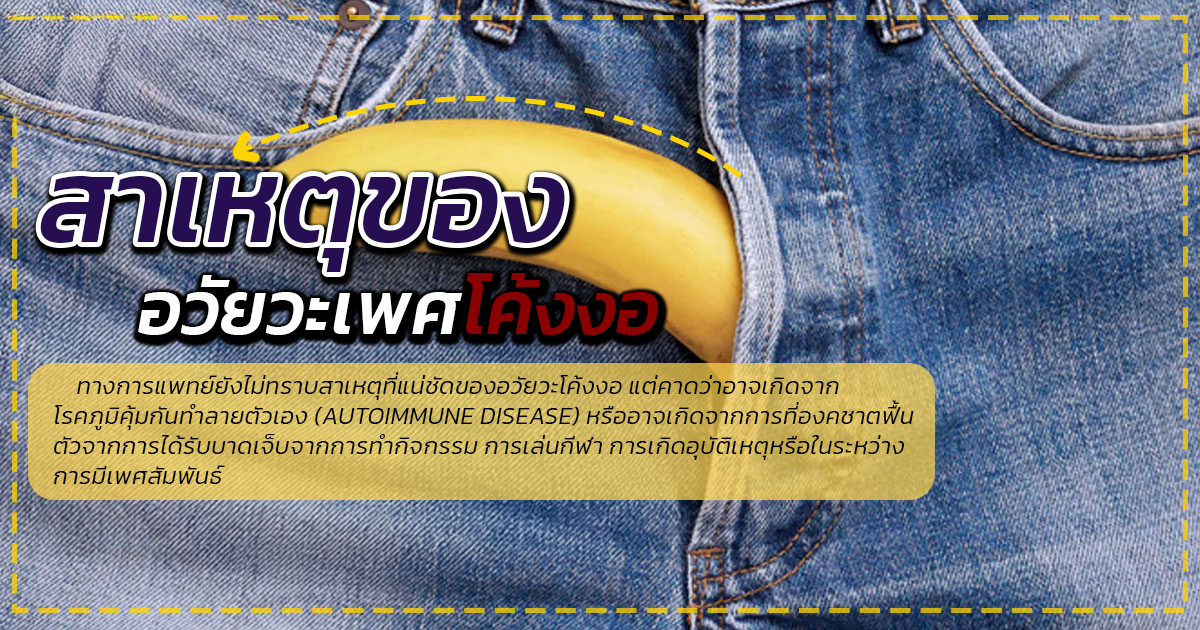อวัยวะเพศโค้งงอ