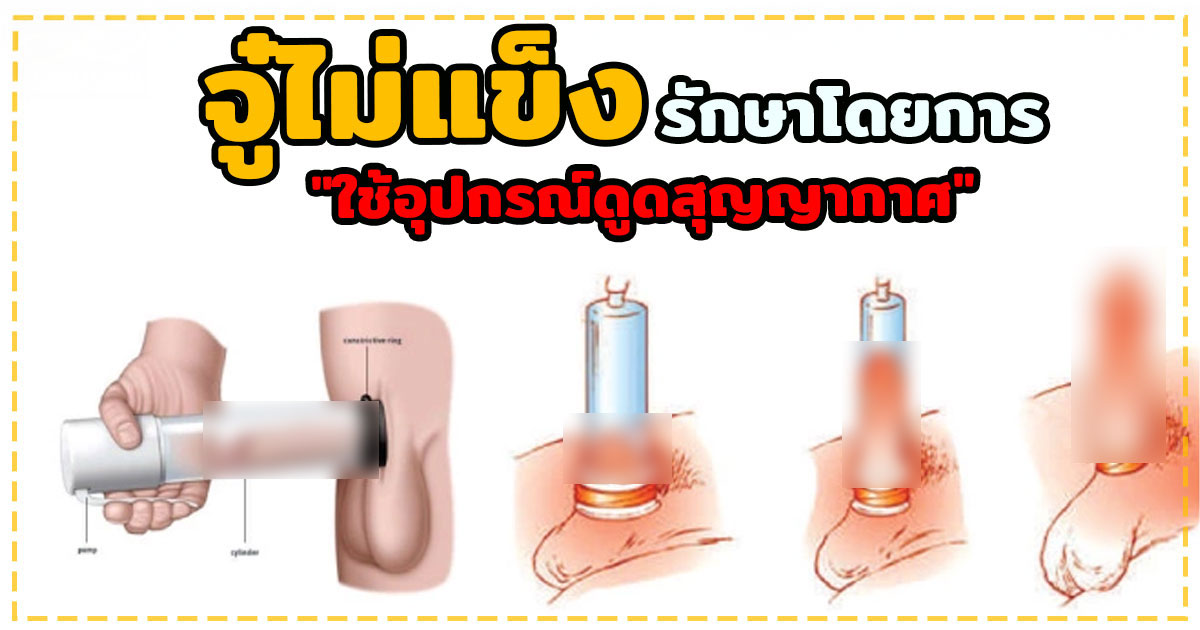 เทสโทสเตอโรน 