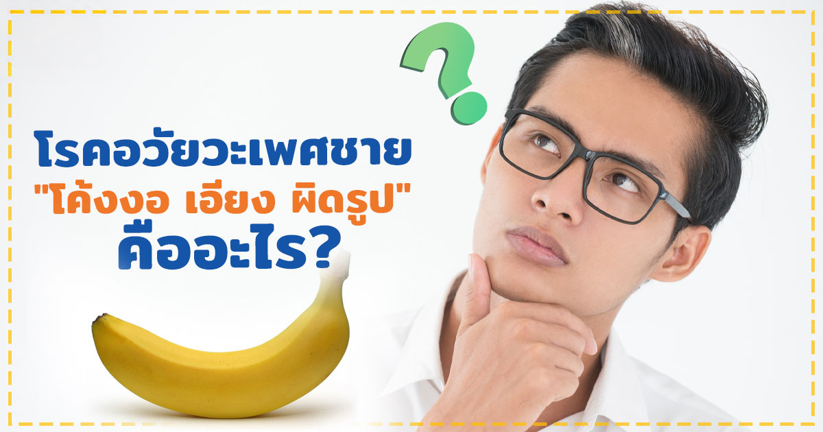 อวัยวะเพศโค้งงอ