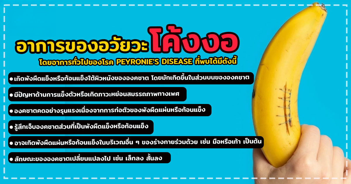 อวัยวะเพศโค้งงอ