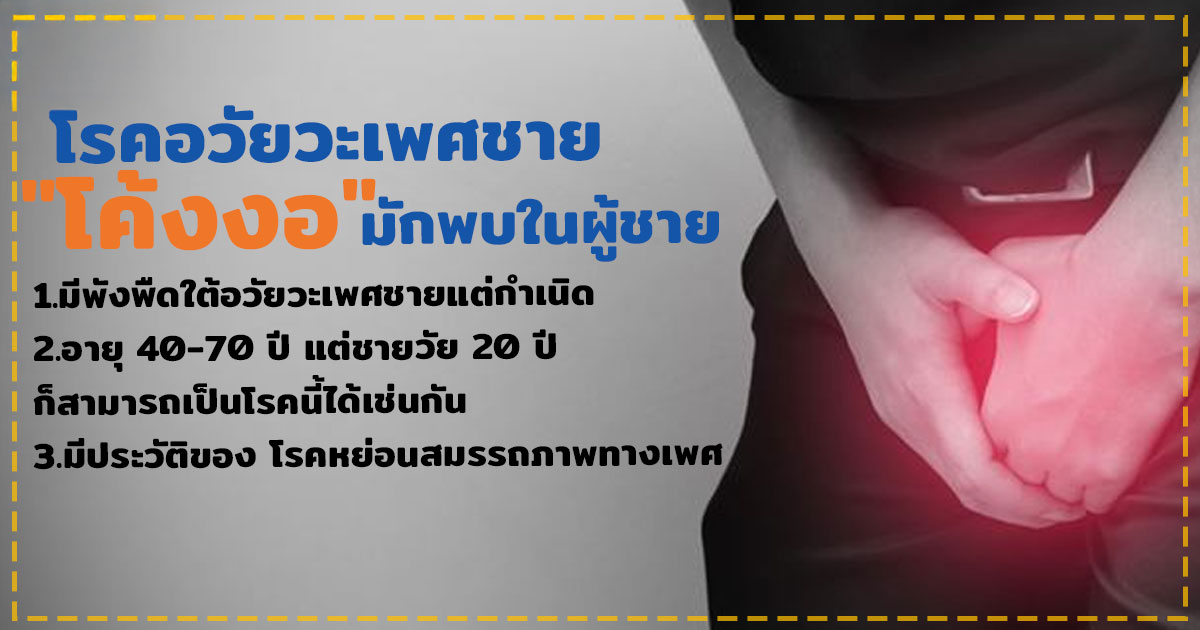 อวัยวะเพศโค้งงอ