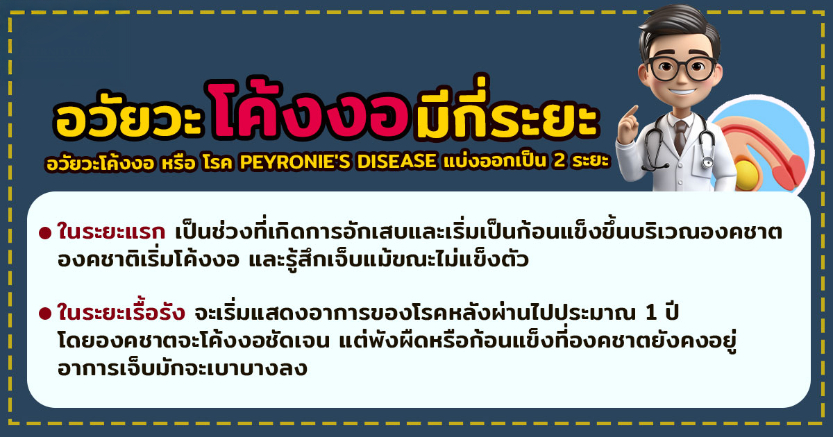 อวัยวะเพศโค้งงอ