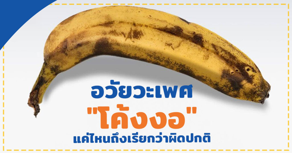 อวัยวะเพศโค้งงอ