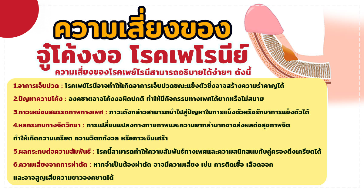ghj - หมอเบียร์ เคลียร์ใจ จู๋โค้งงอ