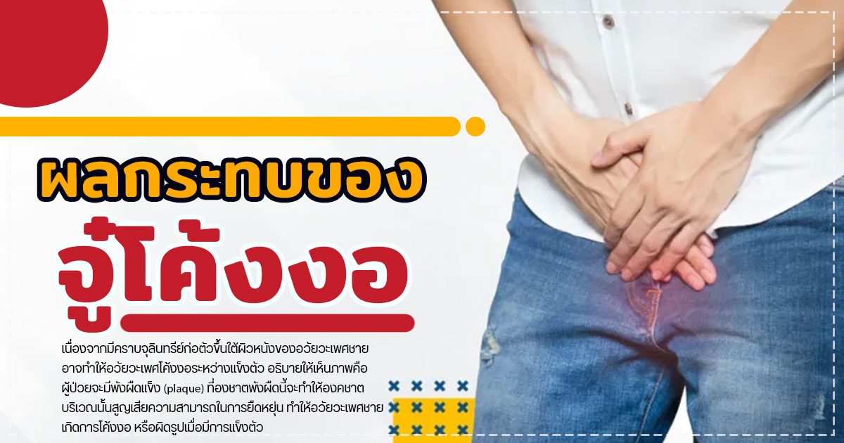 ghjj - หมอเบียร์ เคลียร์ใจ จู๋โค้งงอ