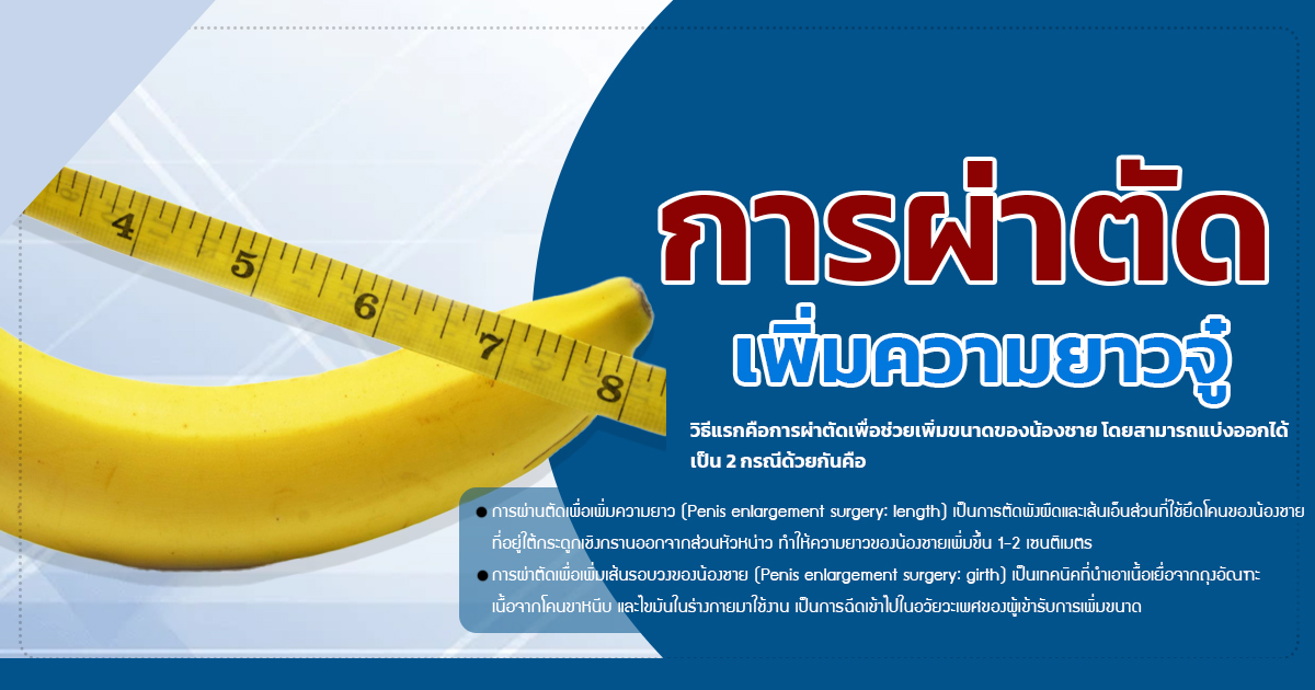 เพิ่มความยาว