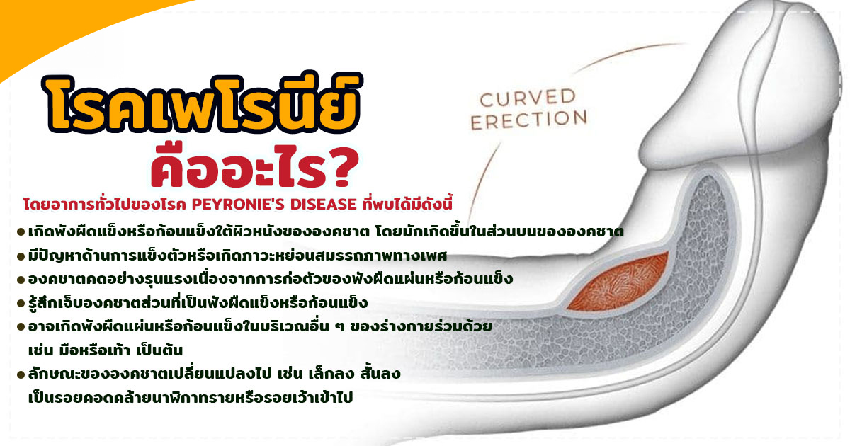 meed - หมอเบียร์ เคลียร์ใจ จู๋โค้งงอ