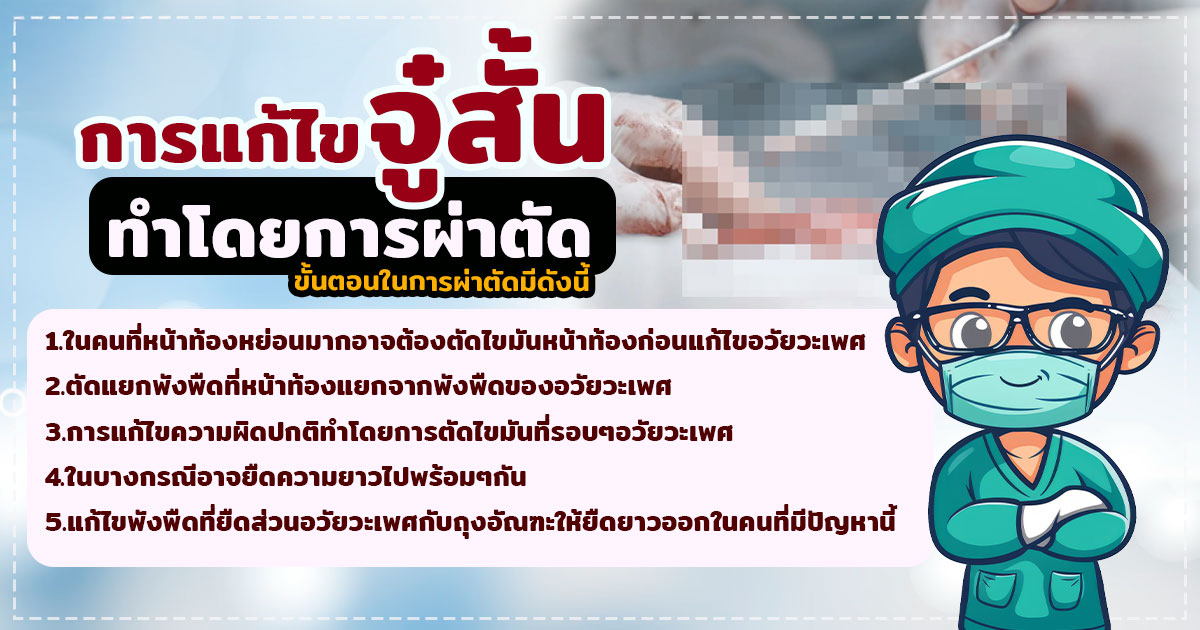 จู๋สั้น