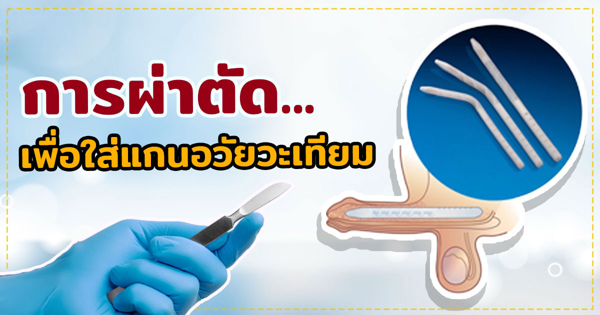 จู๋สั้น