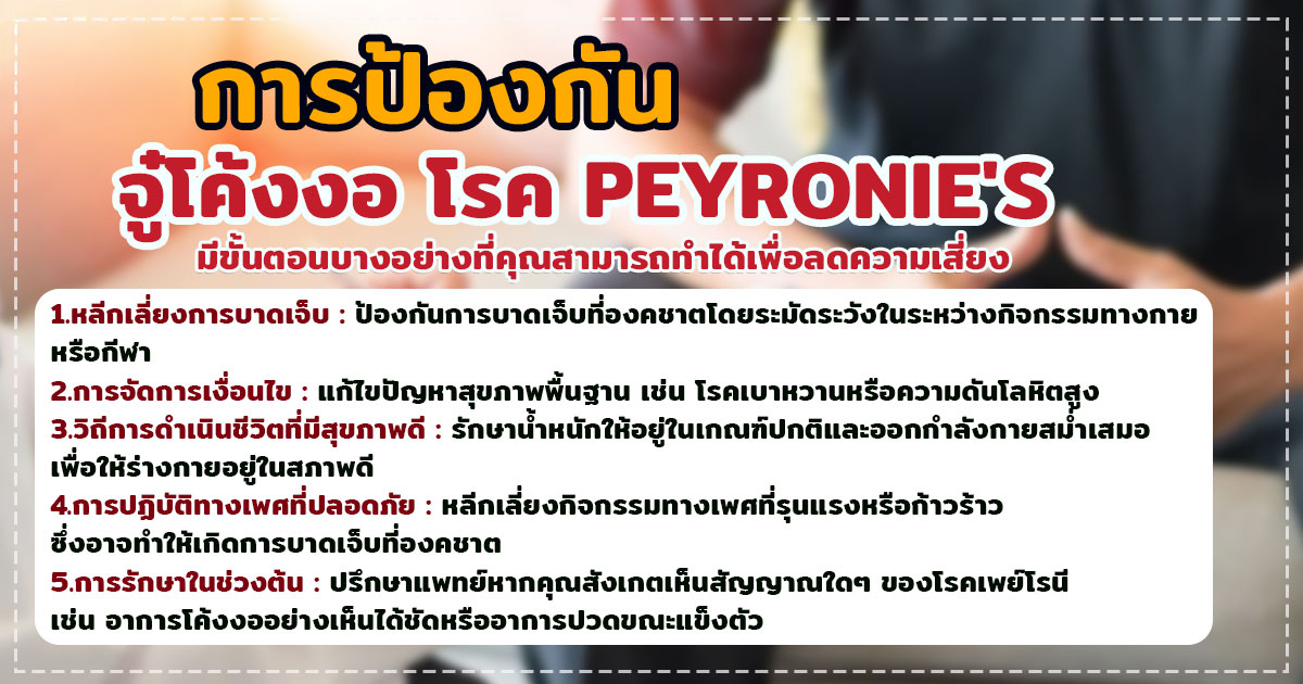 zww - หมอเบียร์ เคลียร์ใจ จู๋โค้งงอ