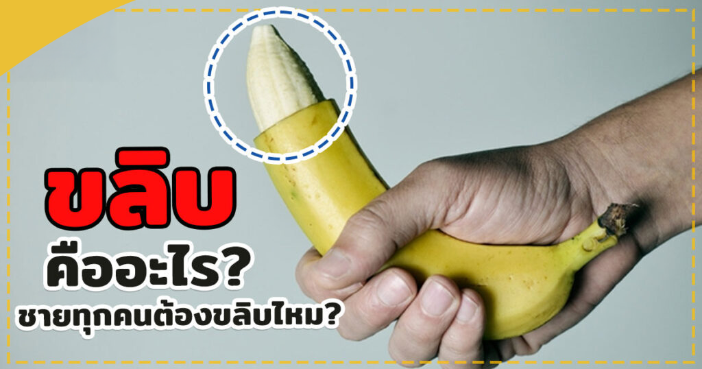 ขลิบไร้เลือด
