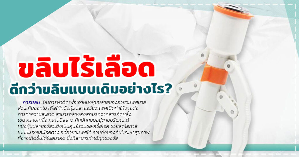 ccv - หมอเบียร์ เคลียร์ใจ ขลิบไร้เลือด