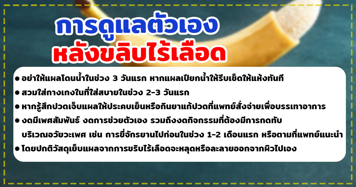 dddd - หมอเบียร์ เคลียร์ใจ ขลิบไร้เลือด