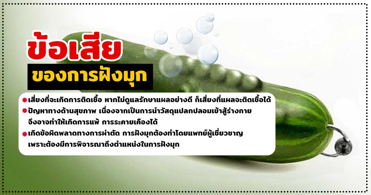 df - หมอเบียร์ เคลียร์ใจ ฝังมุก