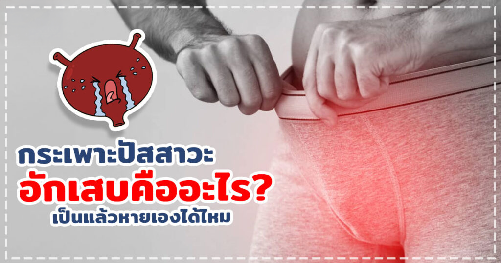 กระเพาะปัสสาวะอักเสบ