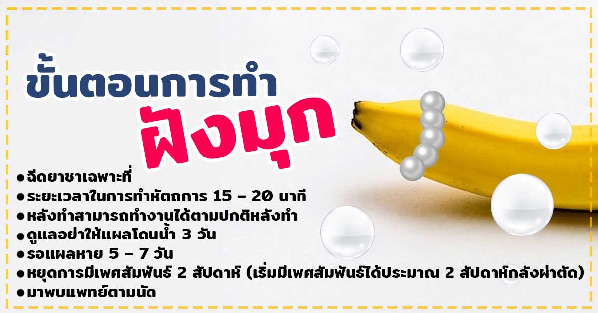 ฝังมุก