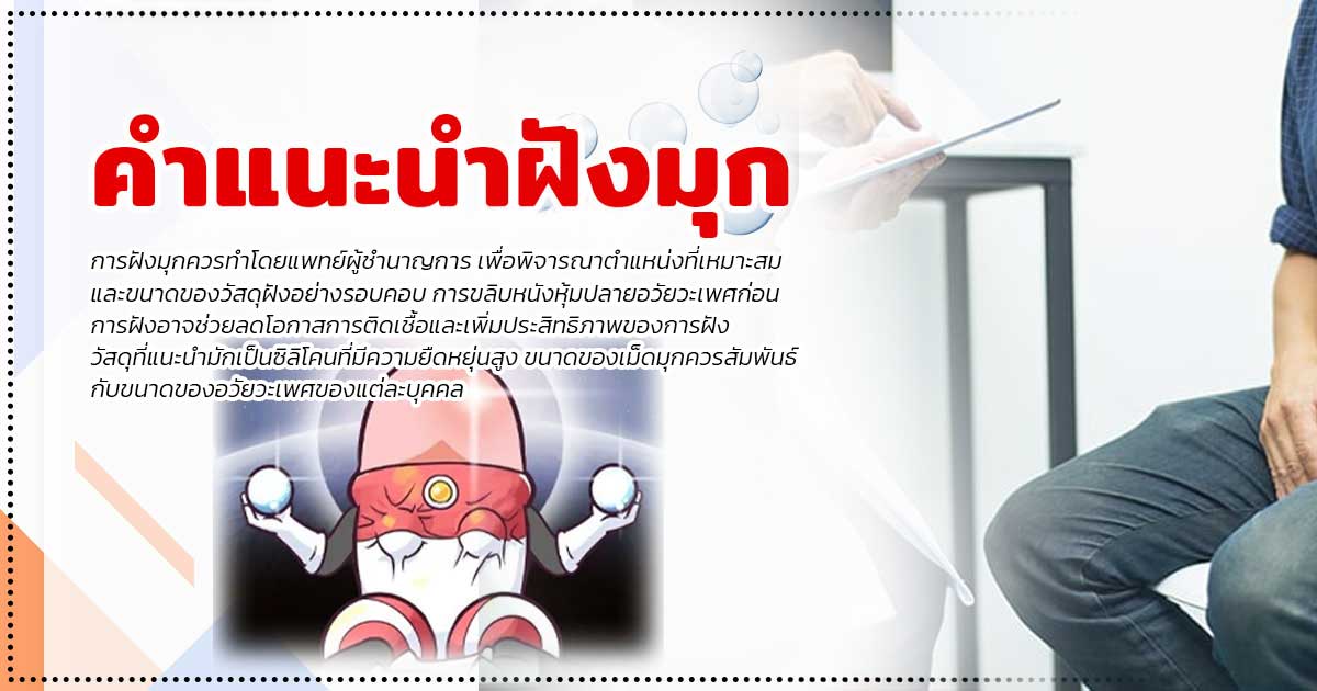 fgg - หมอเบียร์ เคลียร์ใจ ฝังมุก