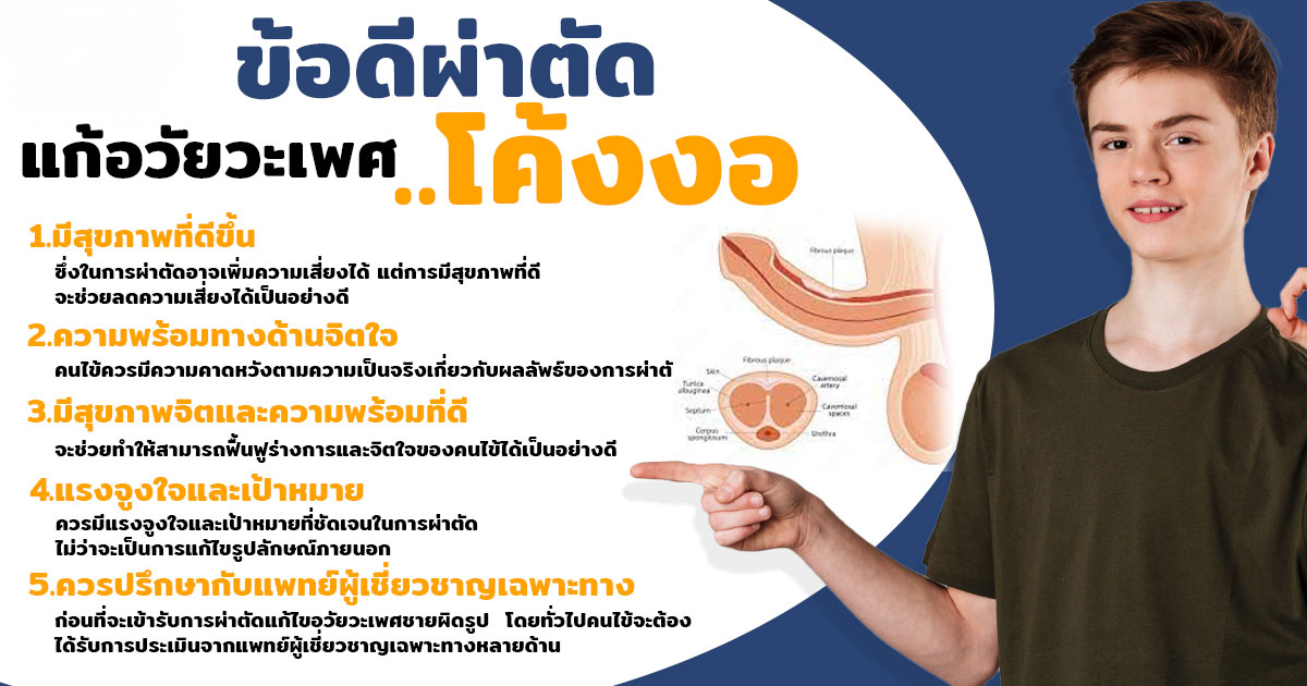 fhj - หมอเบียร์ เคลียร์ใจ อวัยวะเพศโค้งงอ