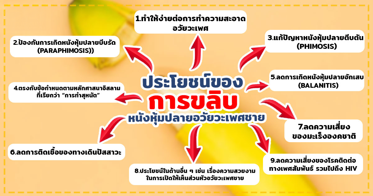 ghj - หมอเบียร์ เคลียร์ใจ ขลิบหนังหุ้มปลาย
