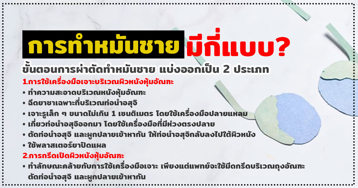 ทำหมันชาย