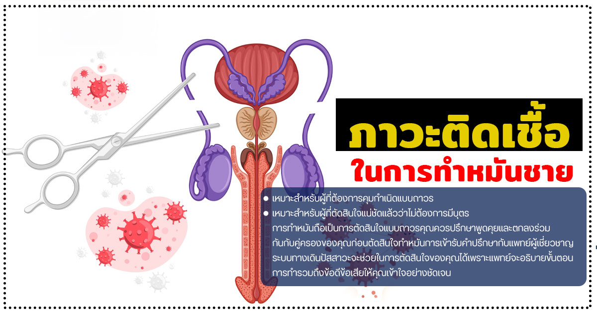 ทำหมันชาย