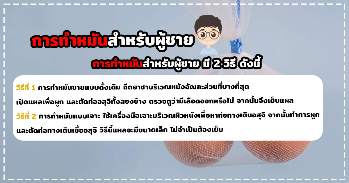 ทำหมัน