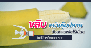 ขลิบหนังหุ้มปลาย
