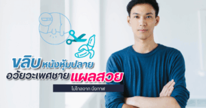 ขลิบไร้เลือด