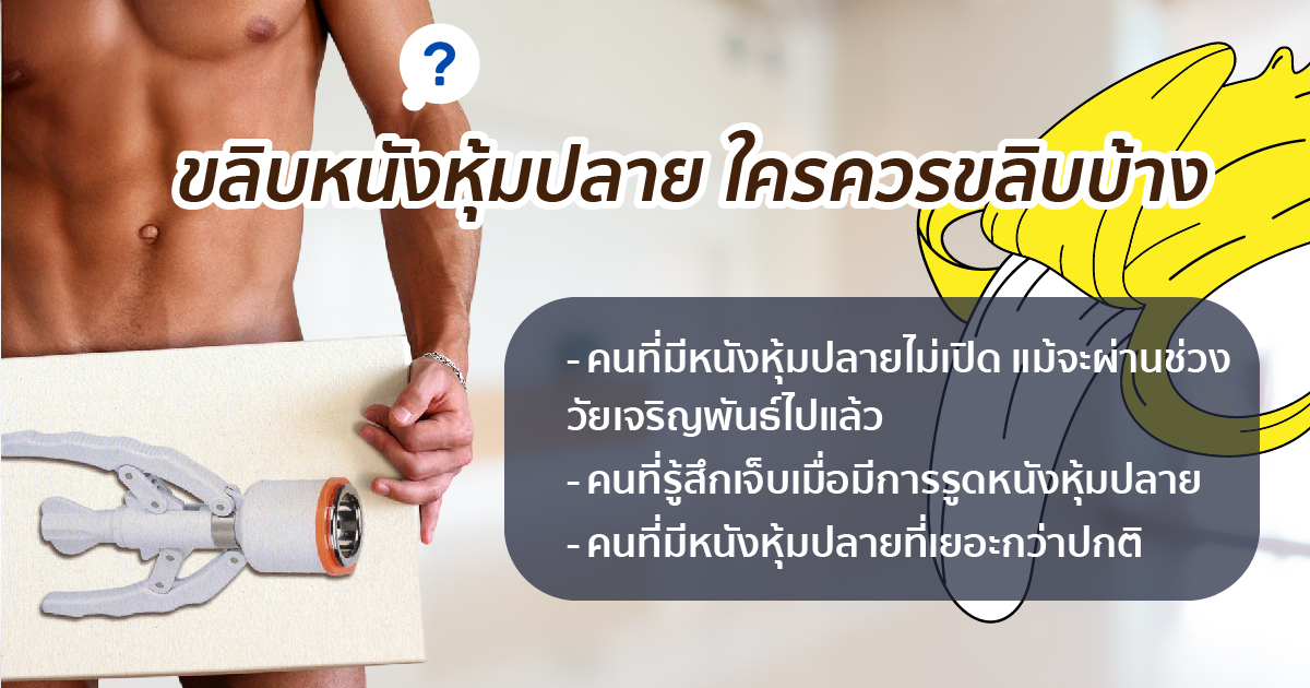 ขลิบหนังหุ้มปลาย