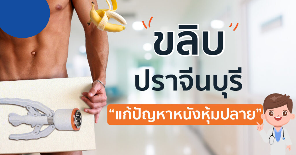 ขลิบไร้เลือด