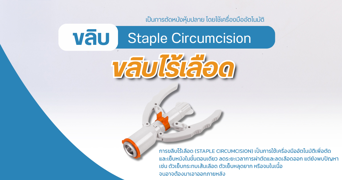 ขลิบหนังหุ้มปลาย