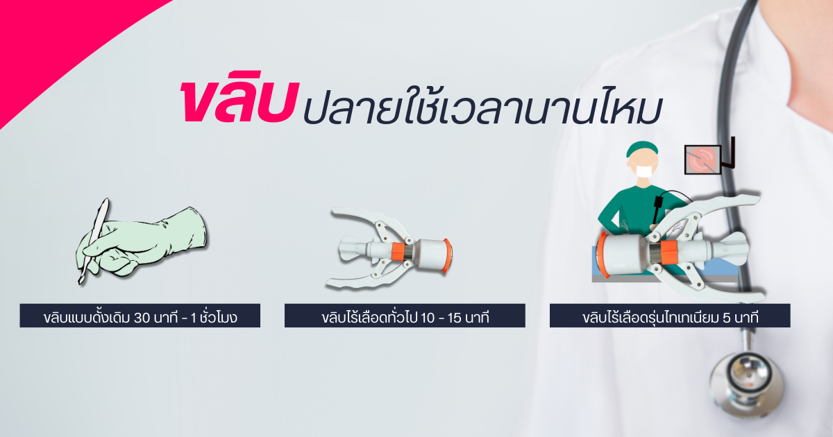 ขลิบไร้เลือด