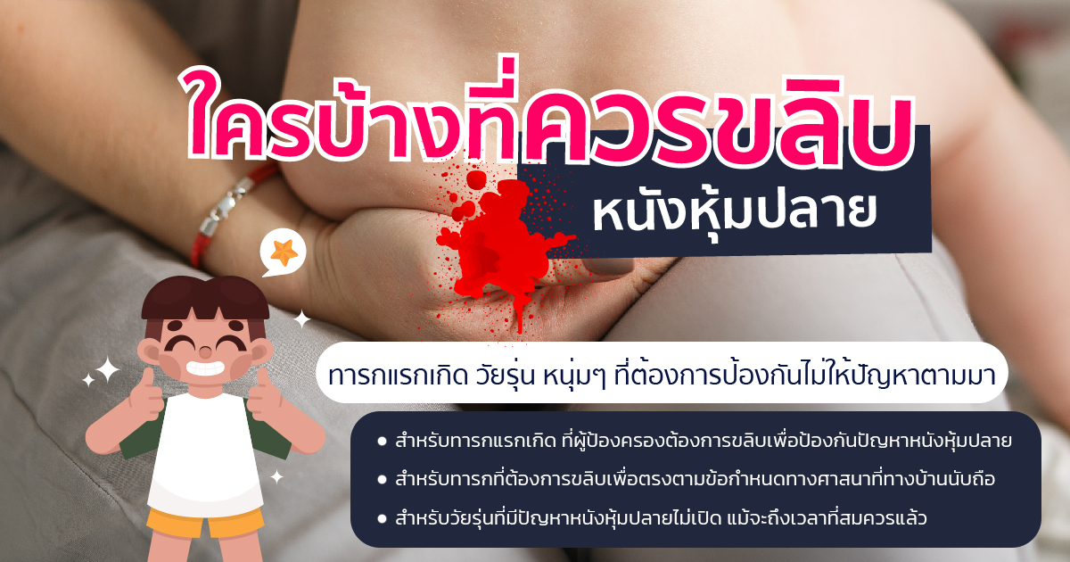 ขลิบหนังหุ้มปลาย