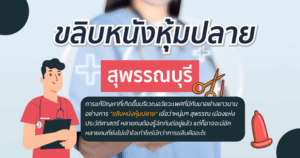 ขลิบหนังหุ้มปลาย