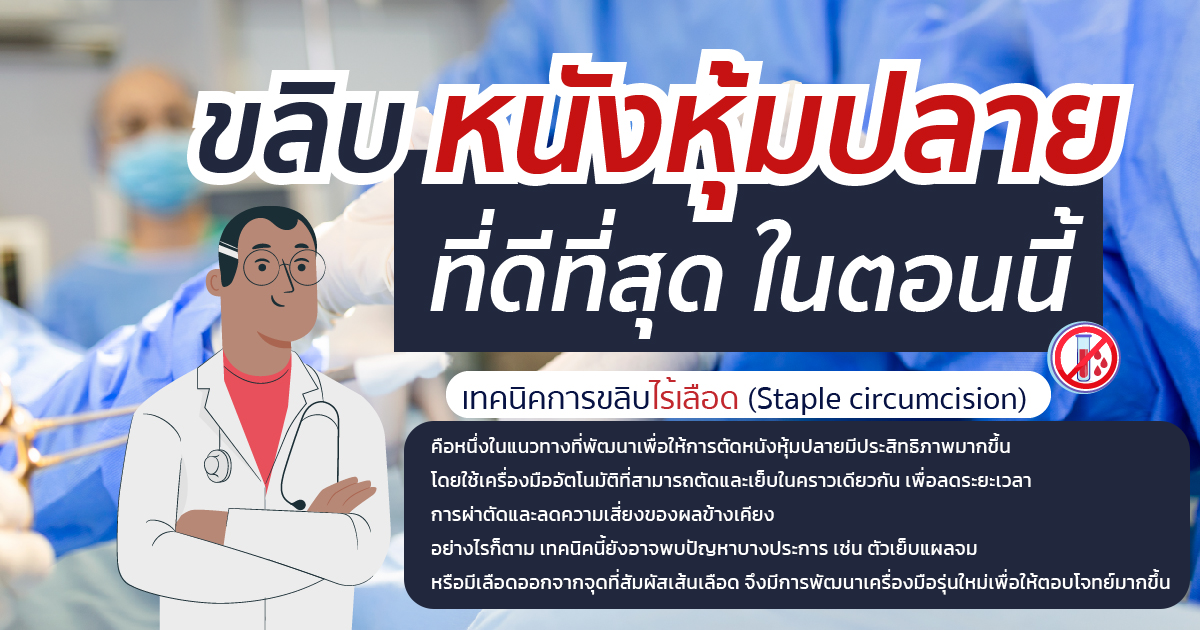 ขลิบหนังหุ้มปลาย