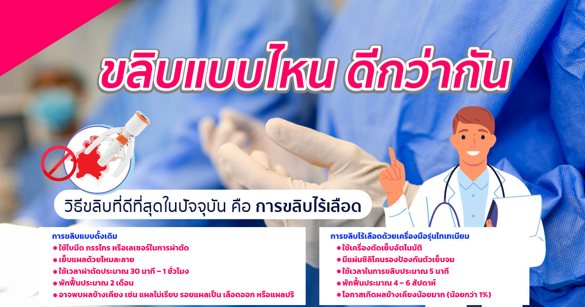 ขลิบหนังหุ้มปลาย