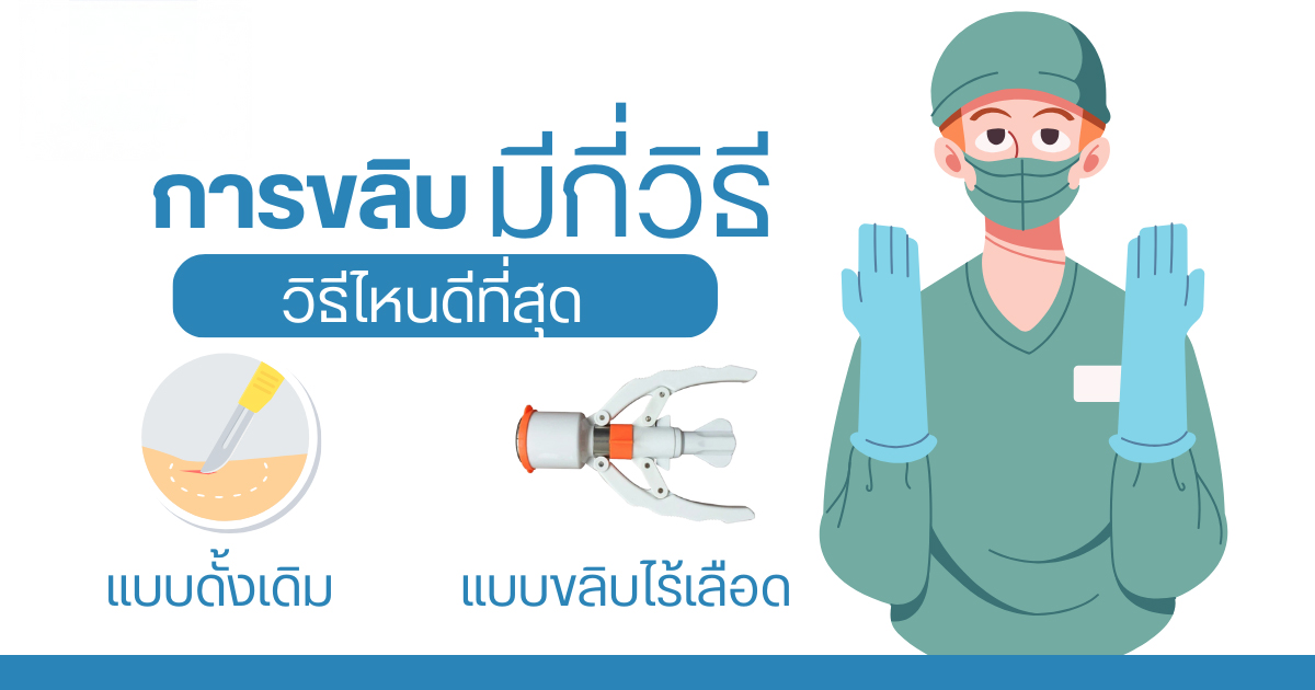 ขลิบหนังหุ้มปลาย