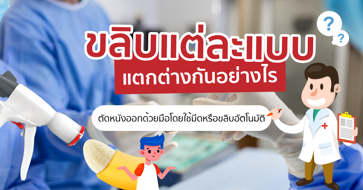 ขลิบไร้เลือด
