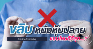 ขลิบหนังหุ้มปลาย