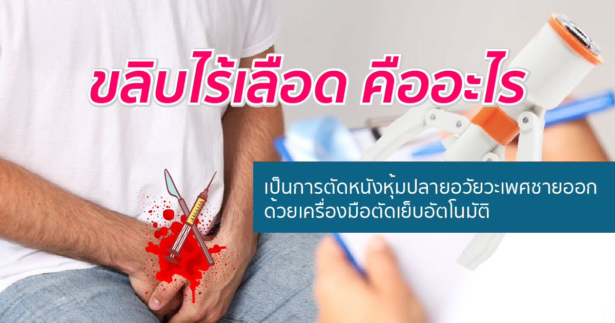 ขลิบหนังหุ้มปลาย