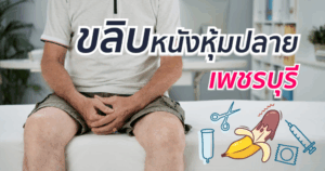 ขลิบหนังหุ้มปลาย