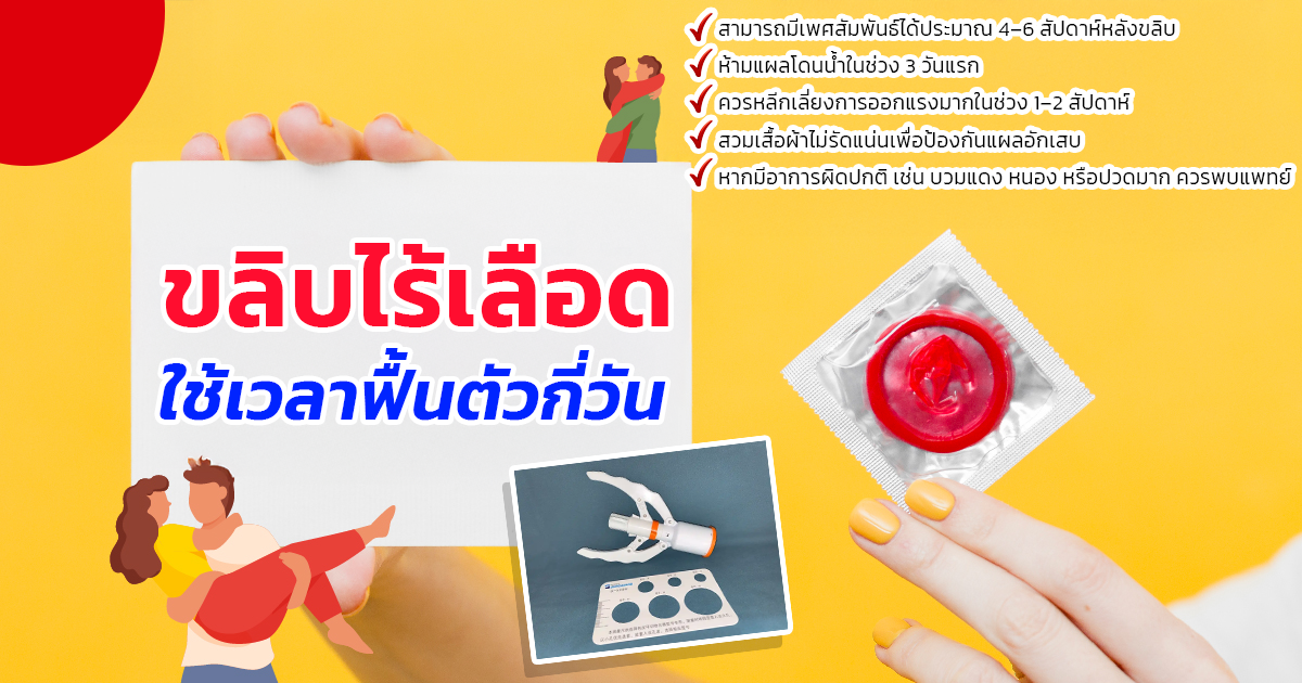 xcf - หมอเบียร์ เคลียร์ใจ ขลิบไร้เลือด