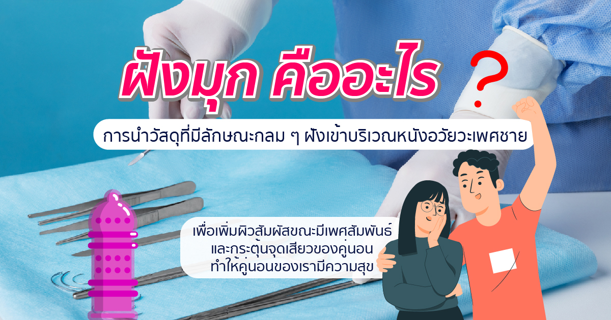 ฝังมุก