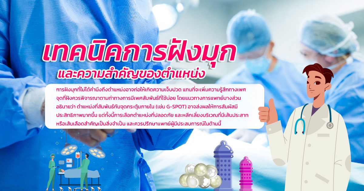 ฝังมุก