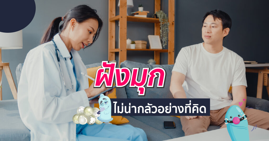 ฝังมุก